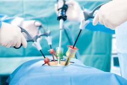 دو‌ سوم جمعیت جهان از عهده هزینه‌های عمل جراحی برنمی‌آید؛ اما دانشمندان درصدد تغییر وضعیت هستند