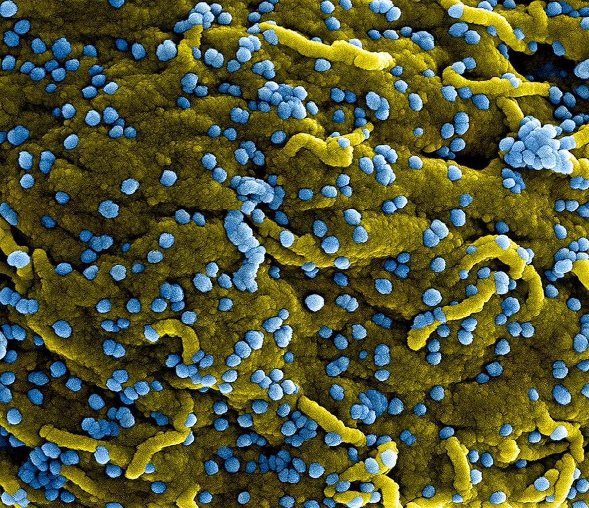 ذرات ویروس ماربورگ / Marburg virus particles