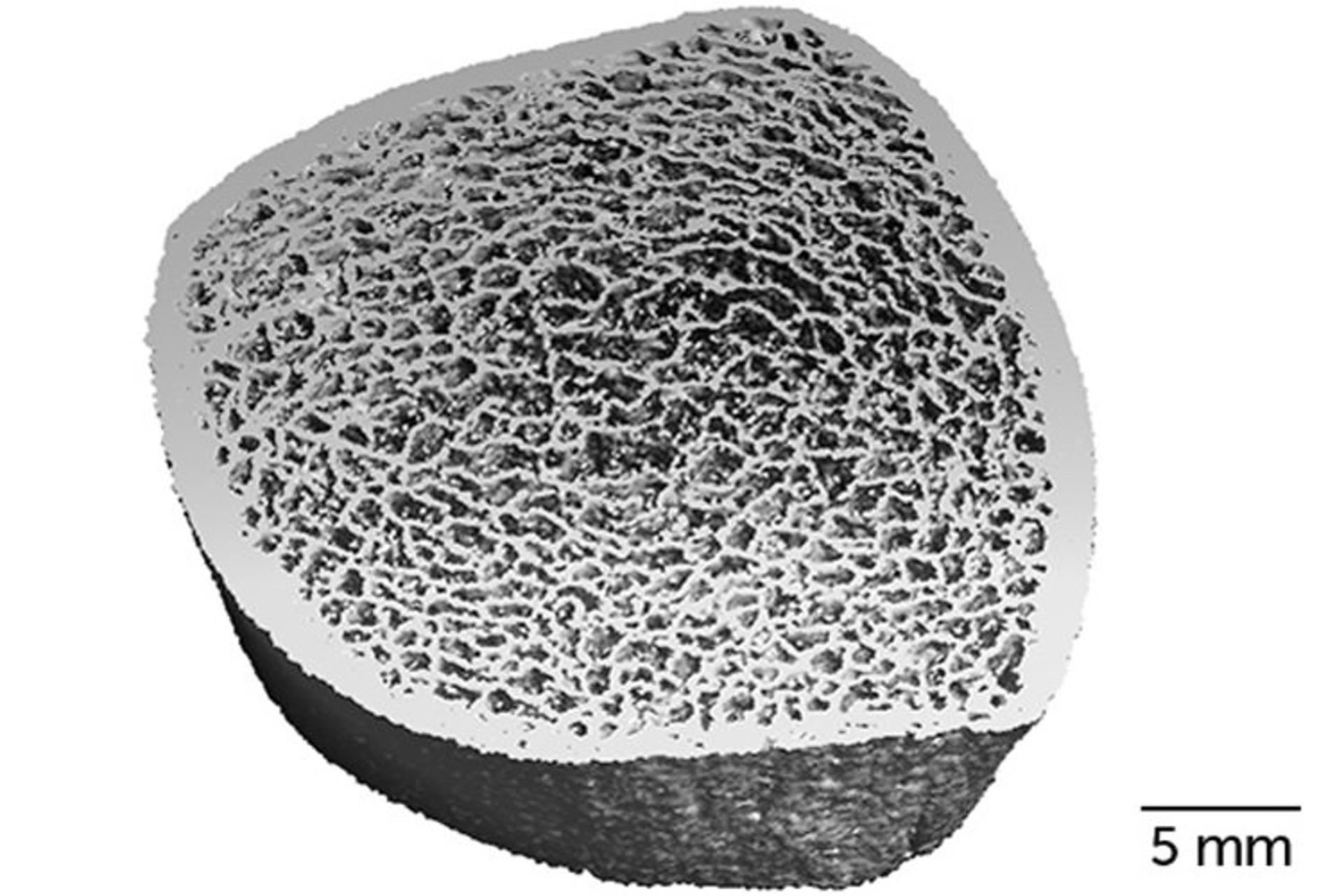 تصویری از استخوان درشت نی ساق پا با روش HR-pQCT 