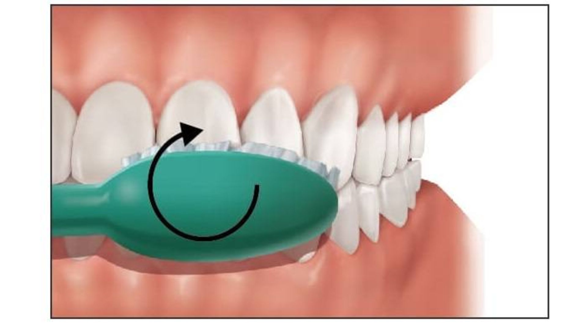 روش مسواک زدن فونس / Fones Brushing technique 