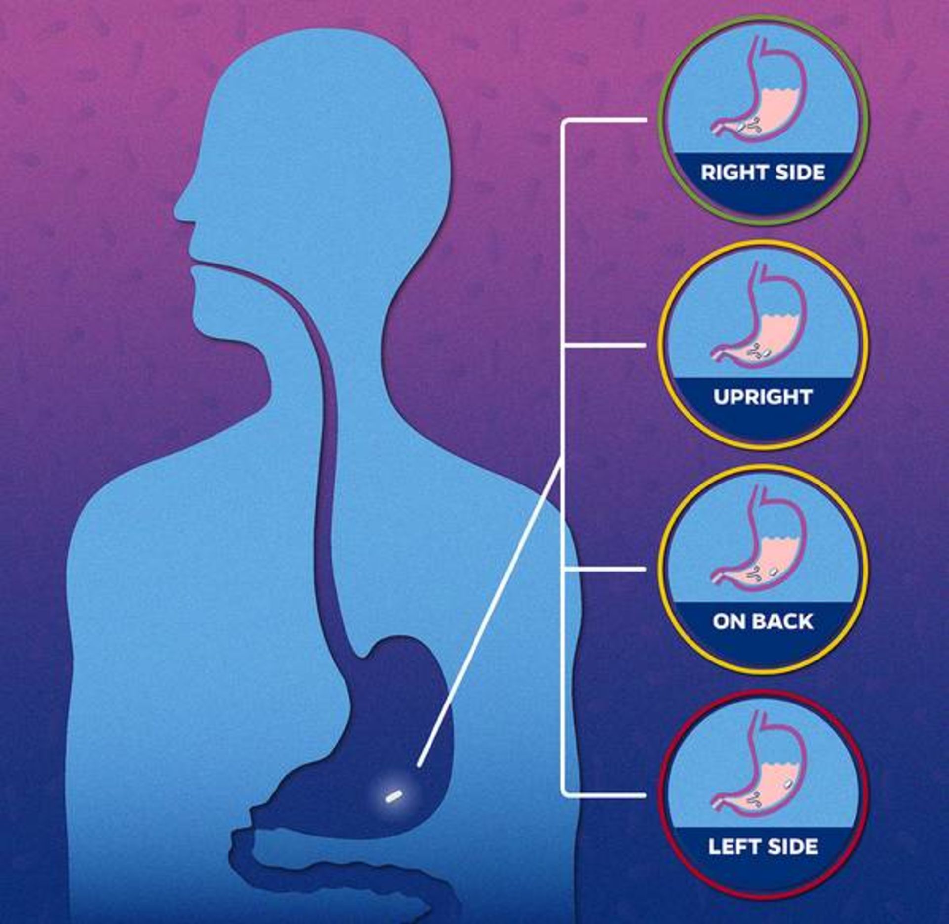 شبیه سازی حل شدن قرص در معده / drug dissolution in stomach