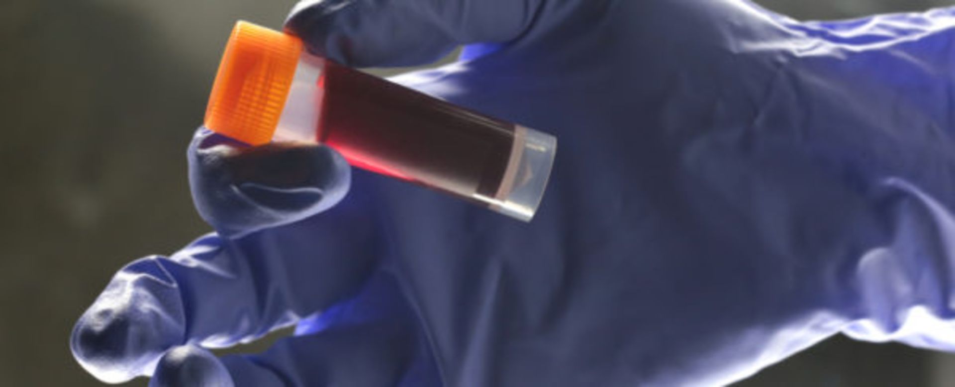 گروه خونی دست انسان