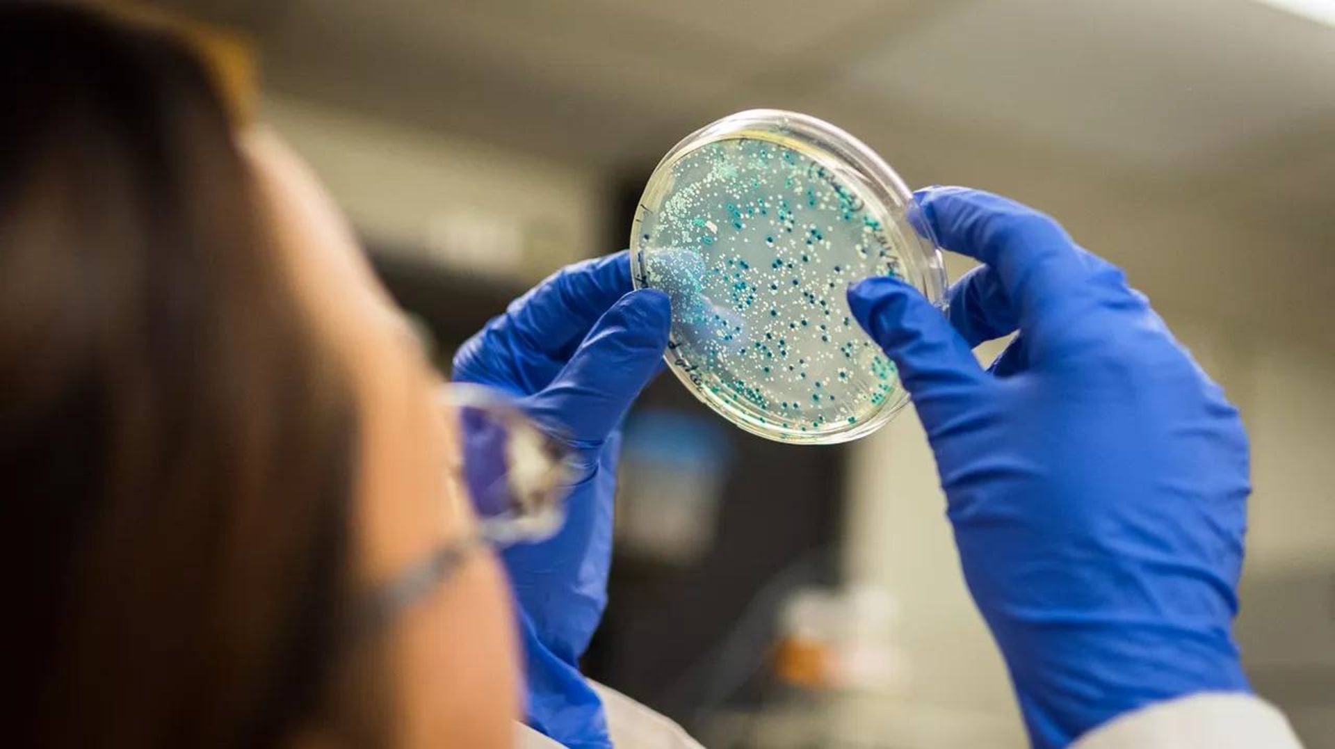 کشت میکروب / petri dish