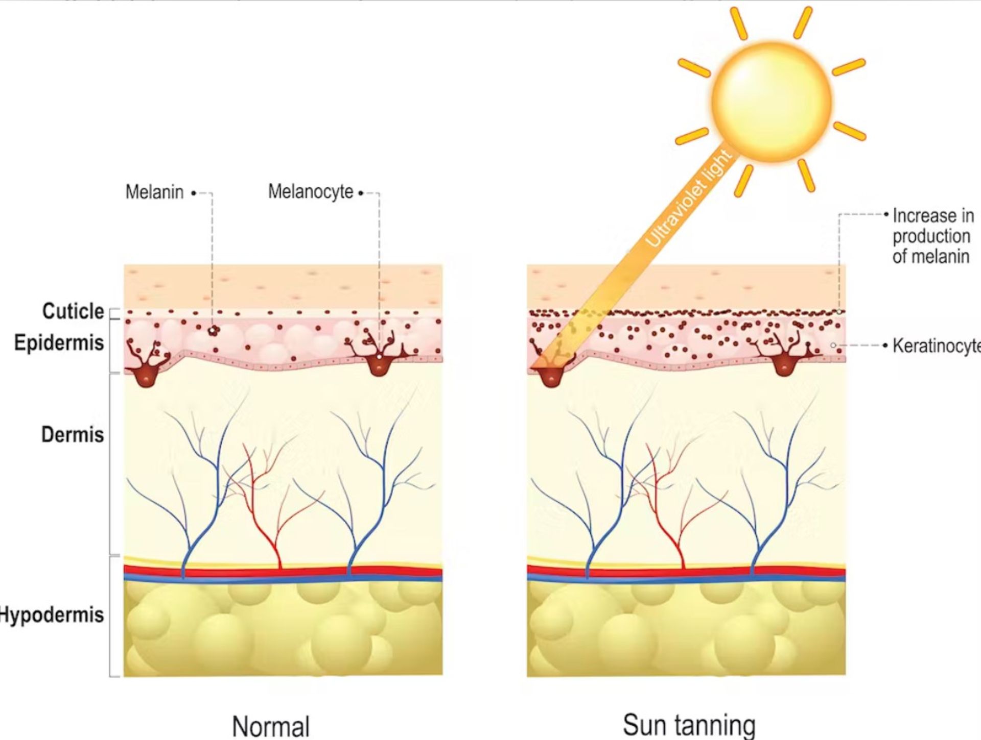 قرارگیری پوست انسان با نور خورشید