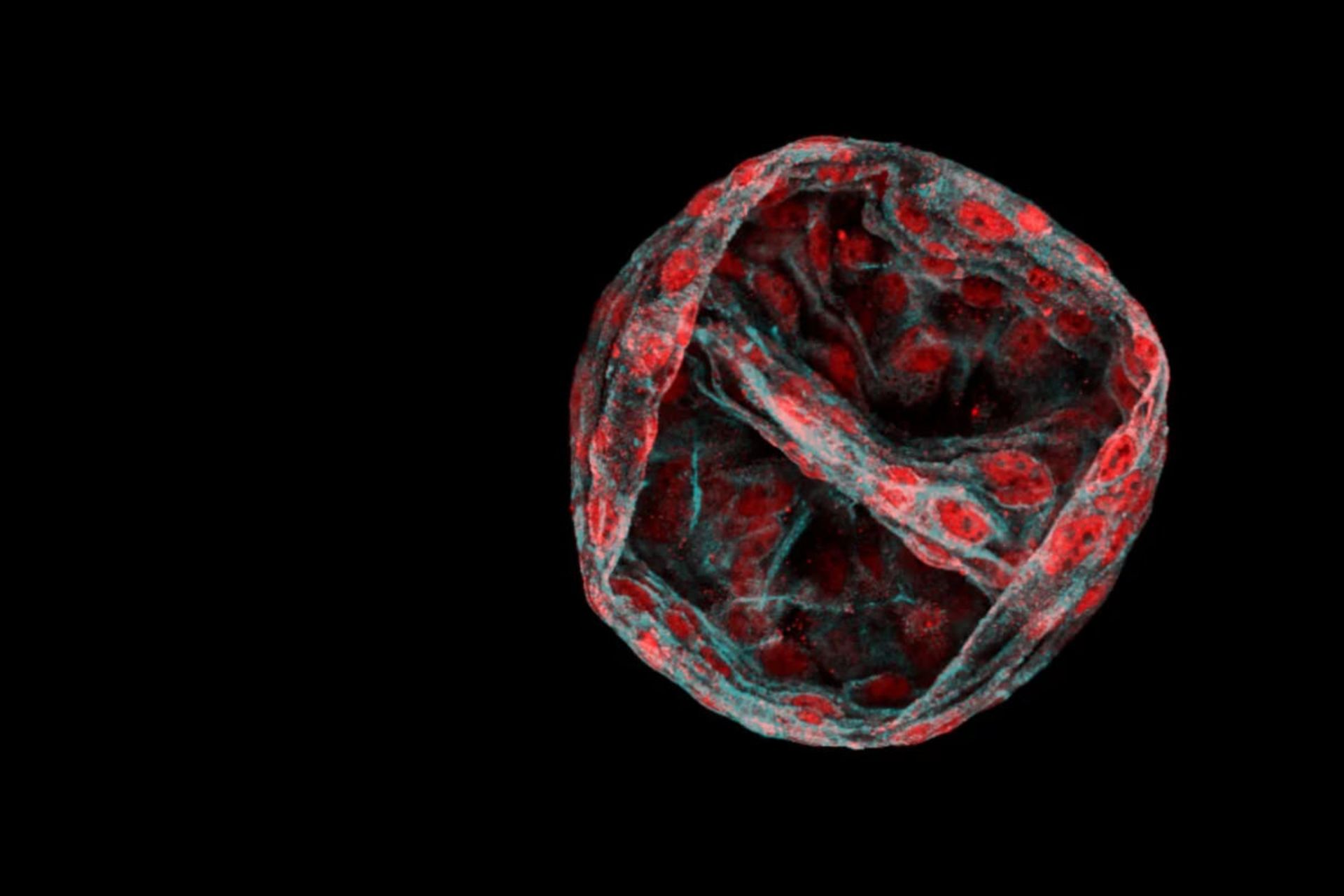 شبه‌اندام یا اُرگانویید از سلول‌های پرتوان روده بزرگ انسان