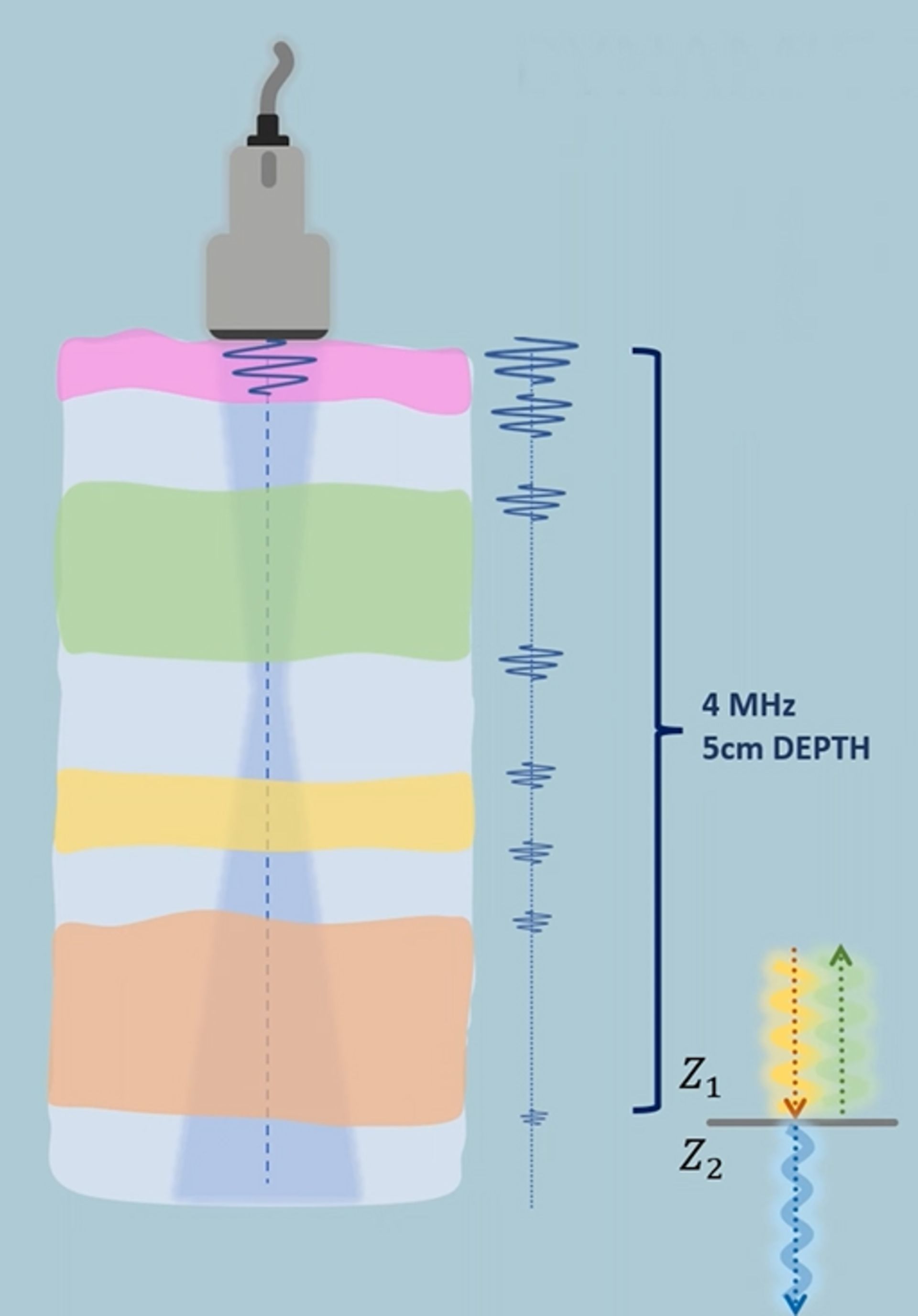 Irradiation of 4 MHz ultrasound wave to the tissue