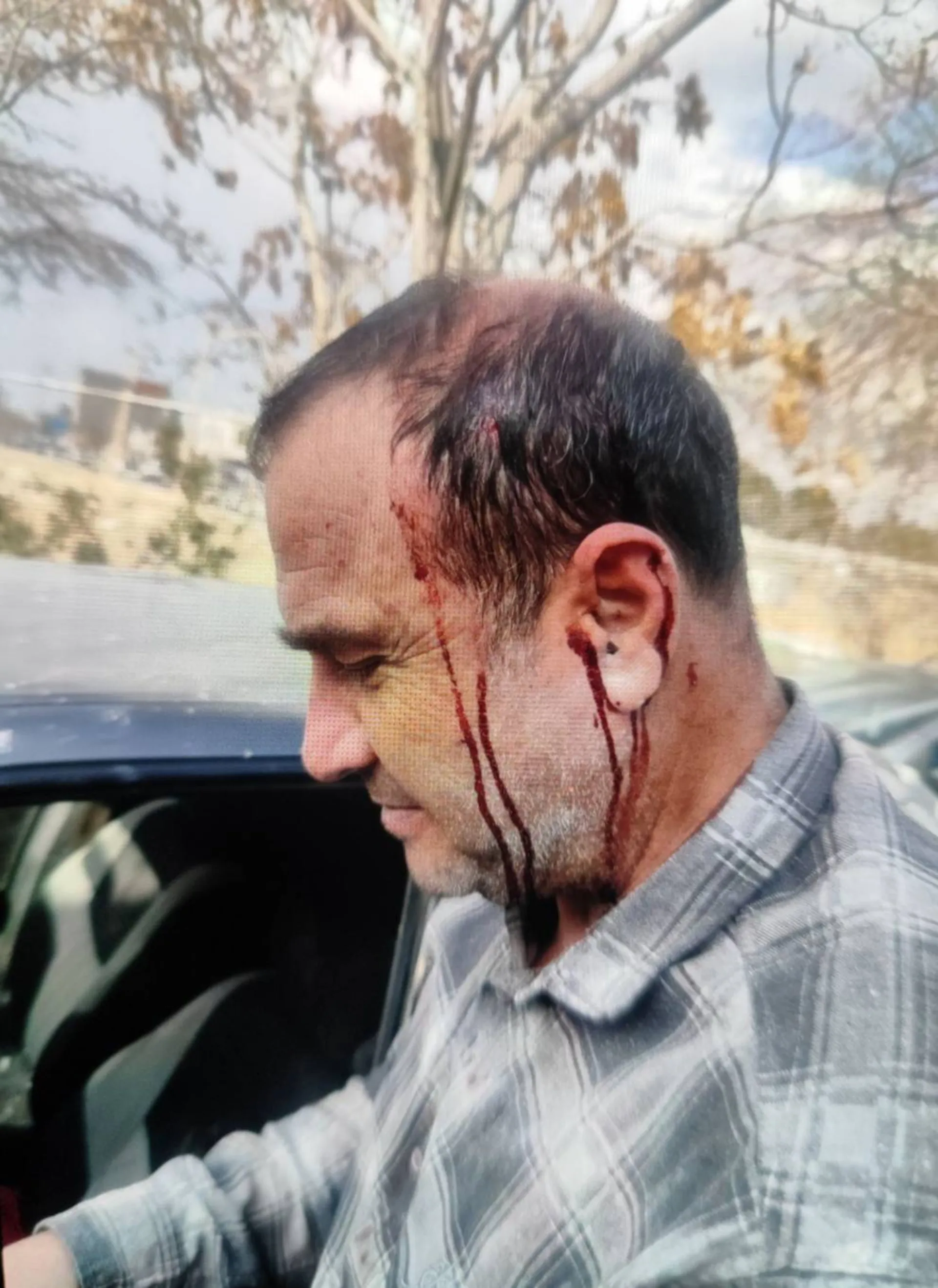 راننده‌های آسیب‌دیده جنگ