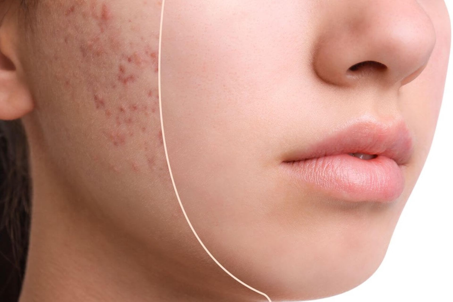 قرص راکوتان