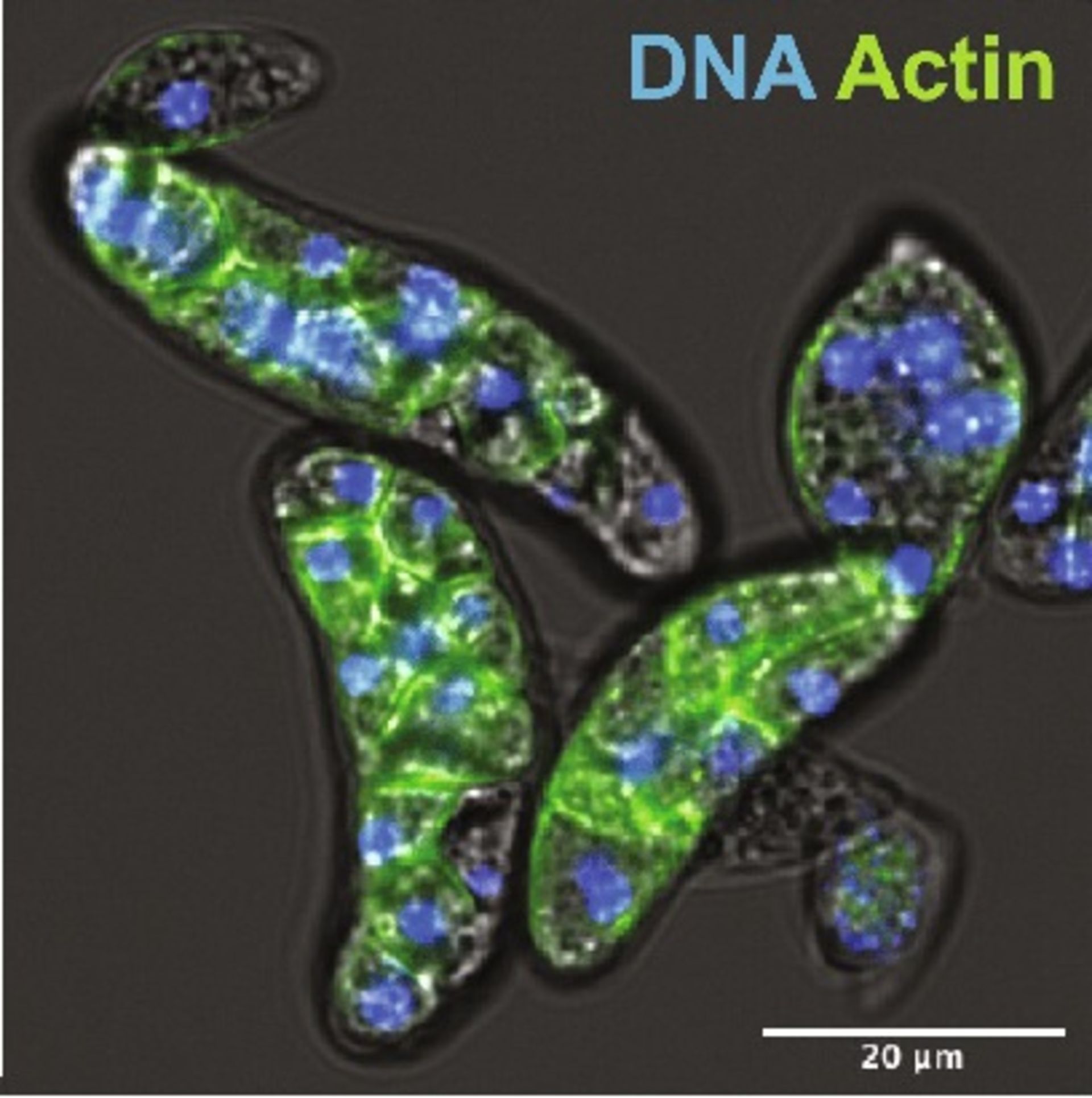 Amoebidium appalachense رنگ‌آمیزی شده با فالویدین همراه DNA (آبی) 