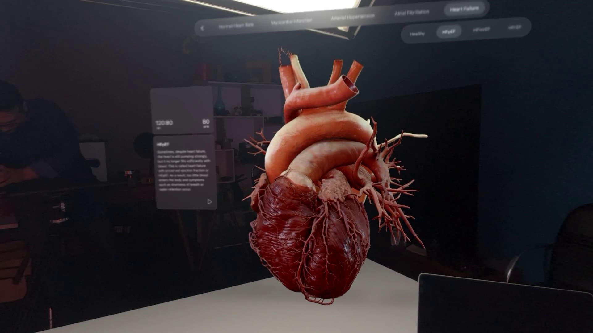 نمایش مدل سه‌بعدی قلب در اپل ویژن پرو
