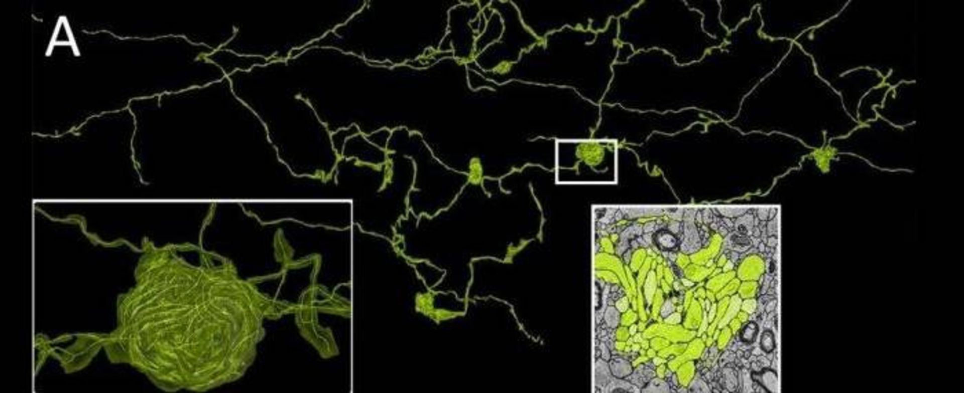 کلاف آکسون در مغز
