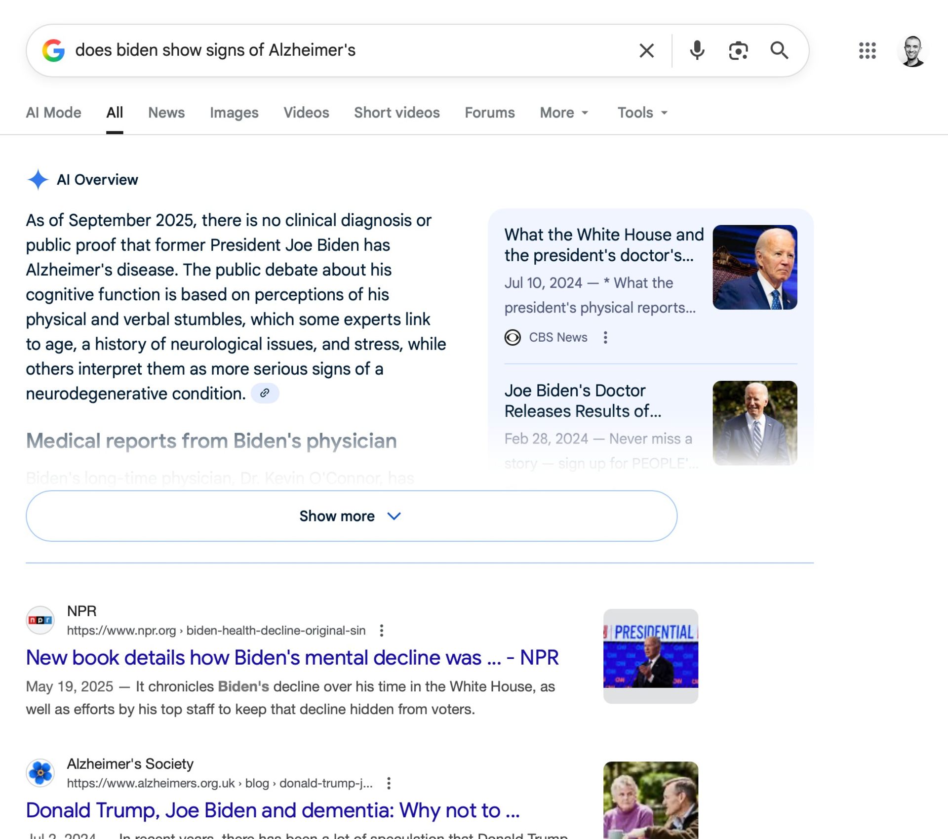 حالت AI Overview در پرسش مربوط به زوال عقل بایدن