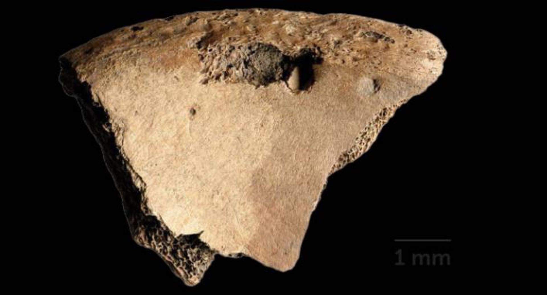 آثار دندان های شیر روی استخوان مرد رومی