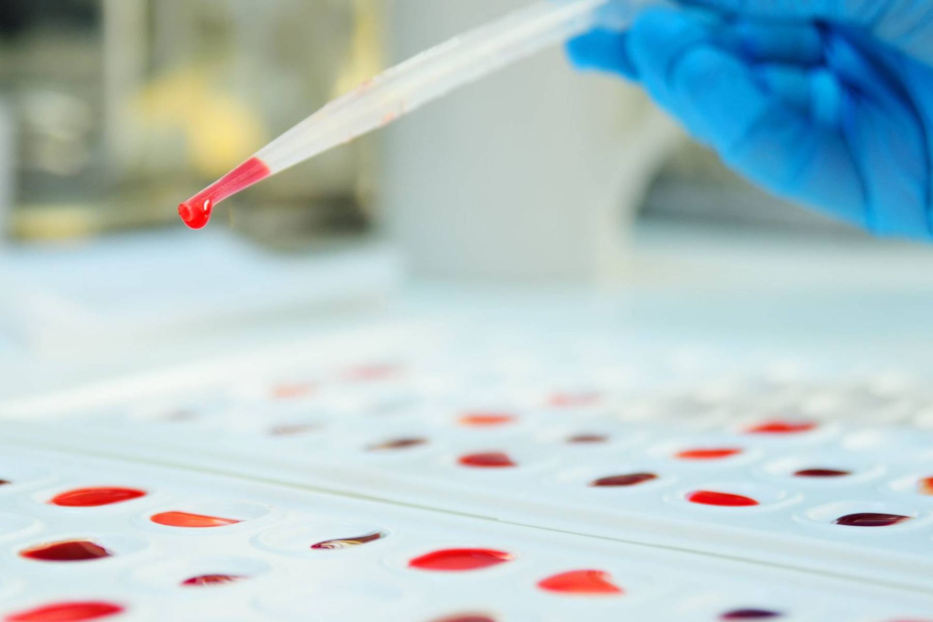 تعیین گروه خونی