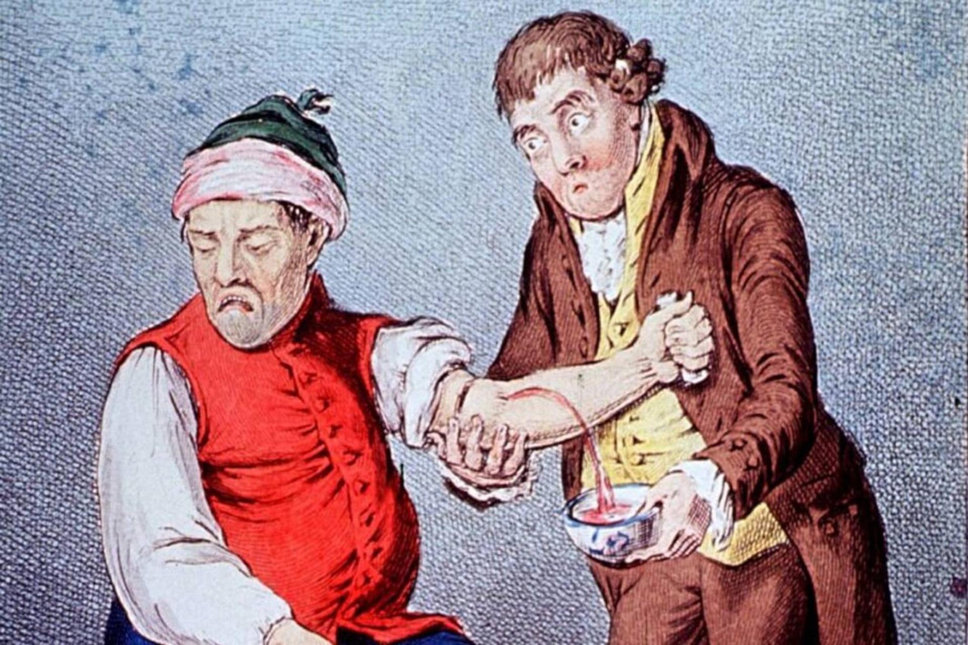 رگ زنی یا خونگیری