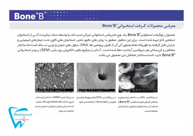 bone+b 01
