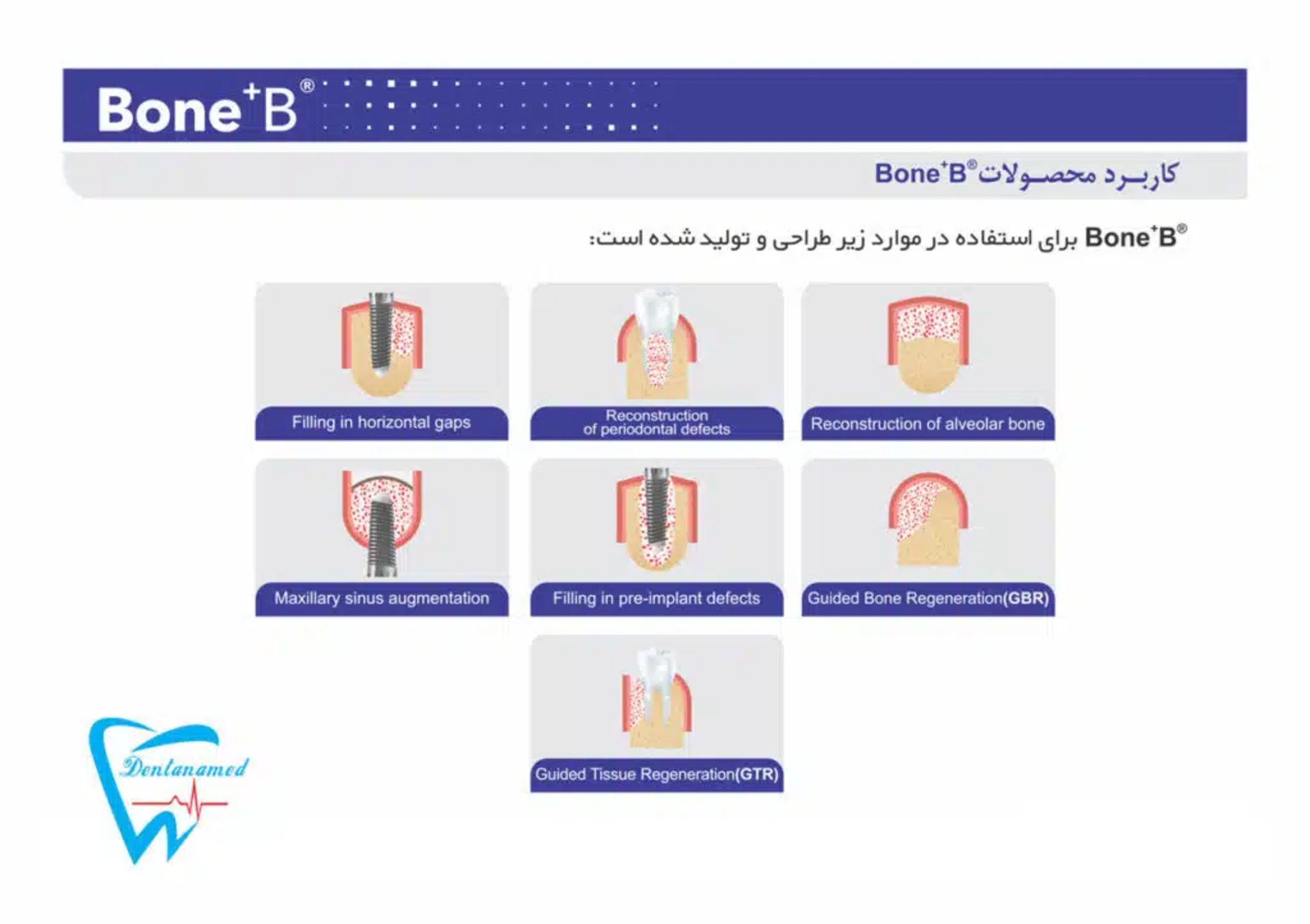 bone+b 02