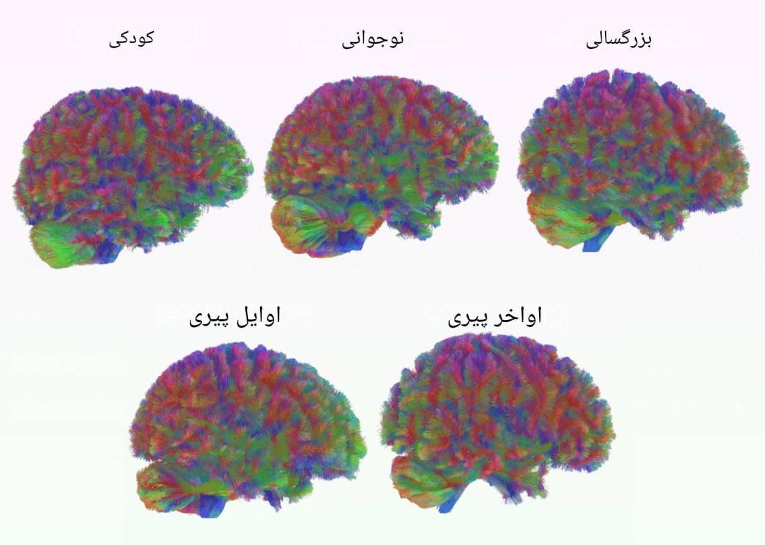 تغییرات مغز در طول زندگی