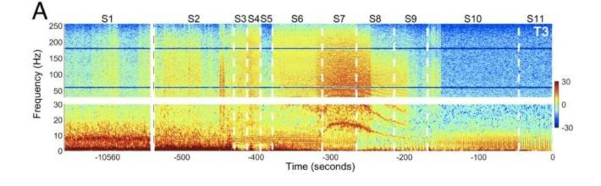فعالیت مغز و امواج مغزی