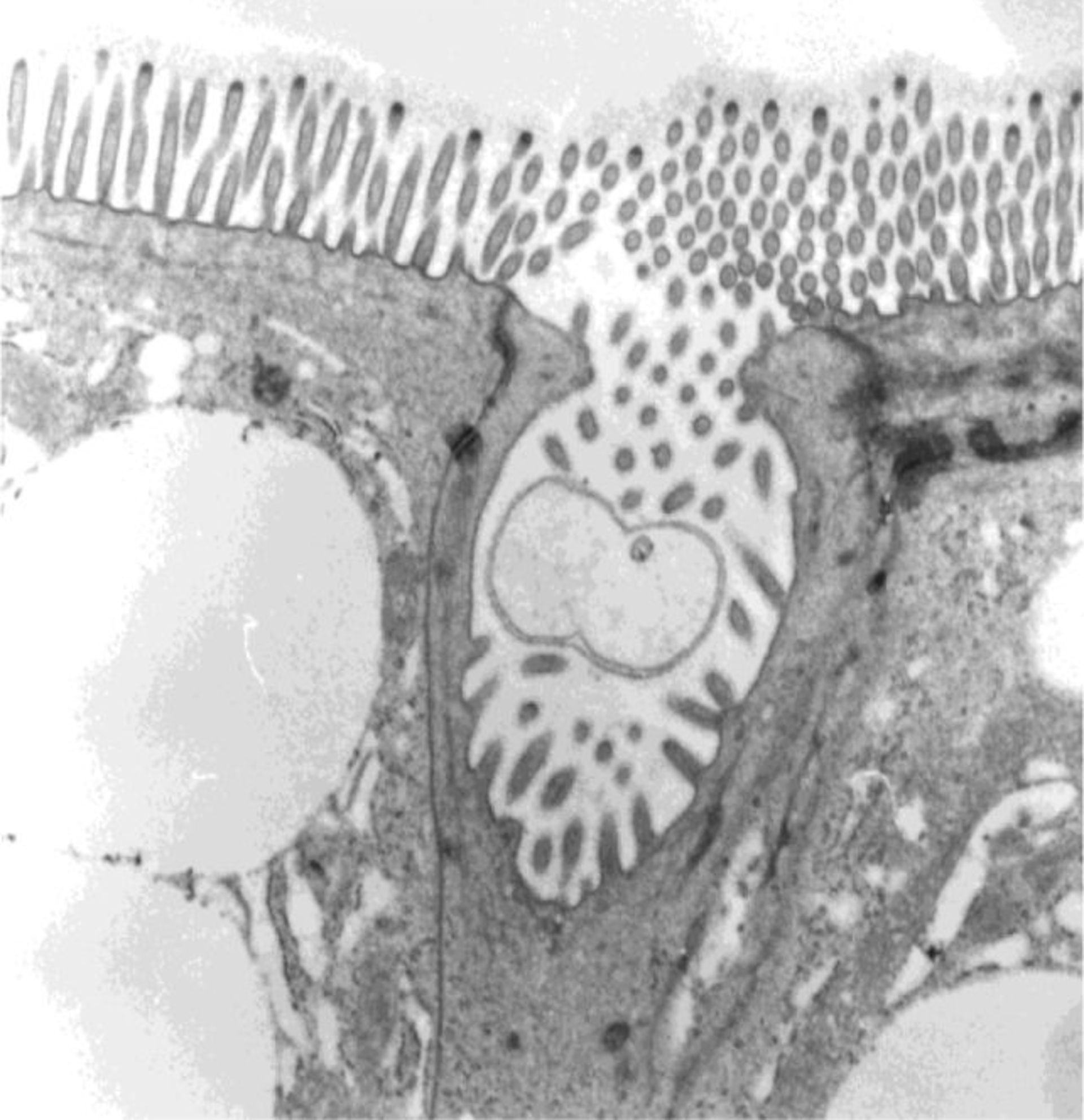 سلول روده‌ای پیتون برمه‌ای با حفره‌ی رأسی و ذره‌ای درون آن