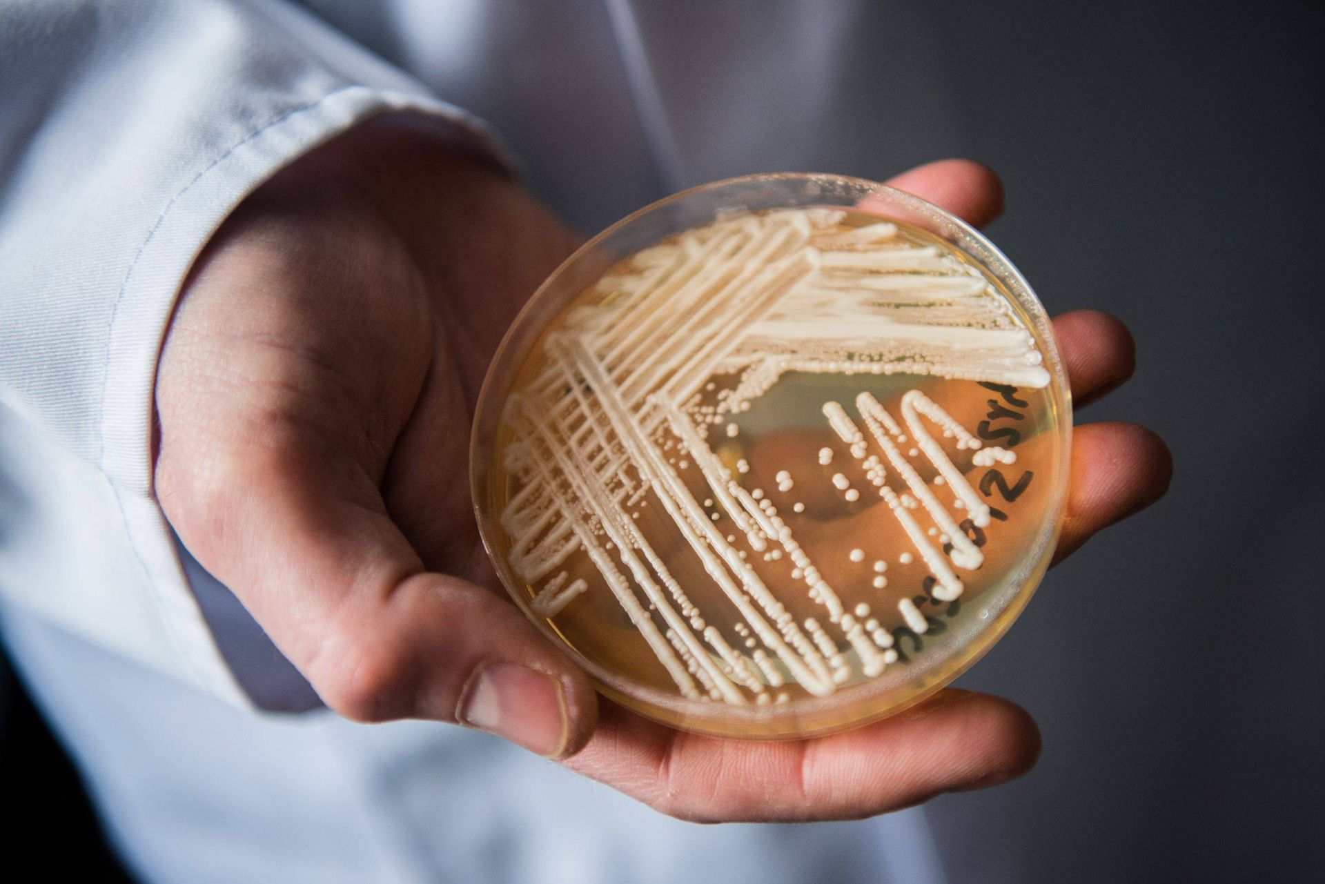 قارچ کاندیدا کشت شده در آزمایشگاه