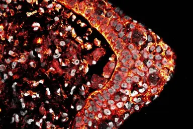 مقطعی از سلول‌های سر انگشت