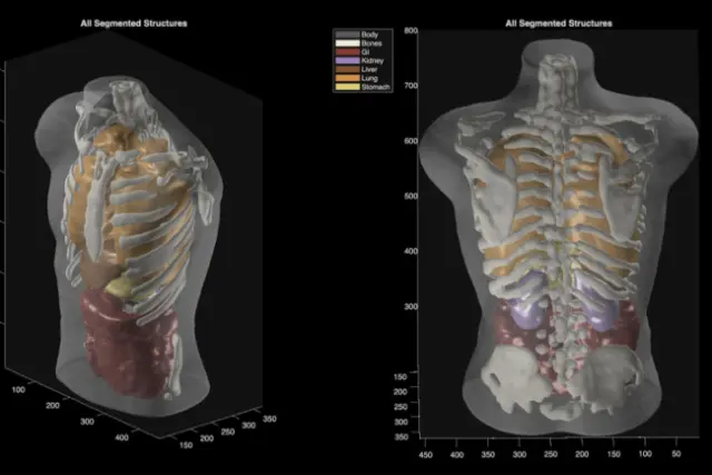 اسکن بدن بدون نیاز به دستگاه MRI؛ پروژه «میدجرنی مدیکال» رونمایی شد