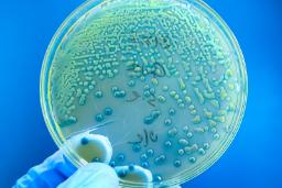 کلونی‌های باکتری در ظرف پتری‌دیش (Petri dish) برای بررسی مقاومت آنتی‌بیوتیکی