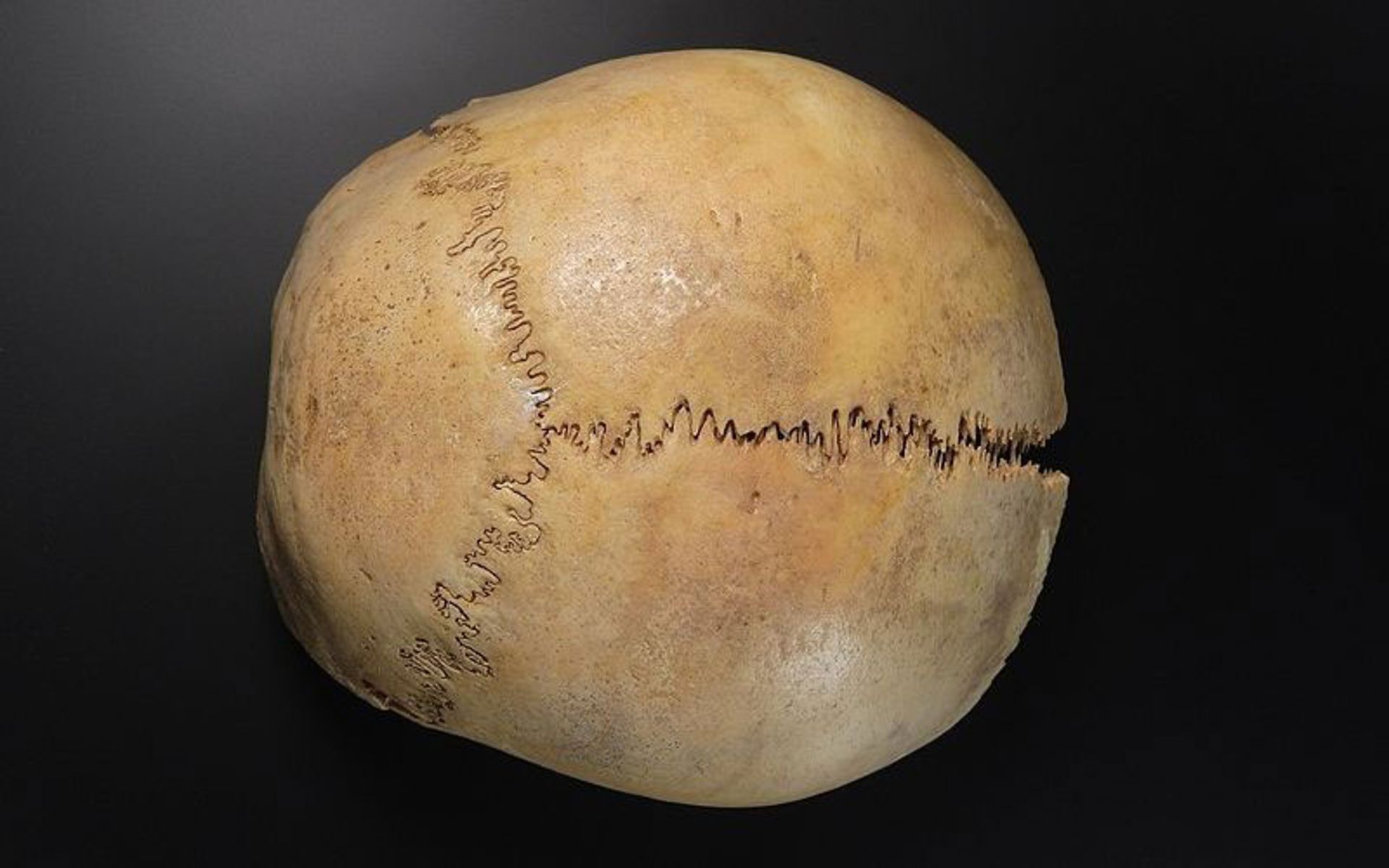 درزهای جمجمه‌ای 