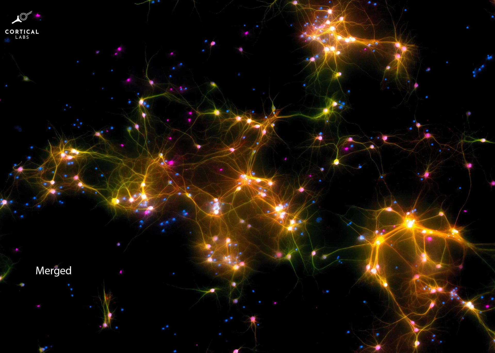 سلول های عصبی پردازنده DishBrain با رنگ روشن