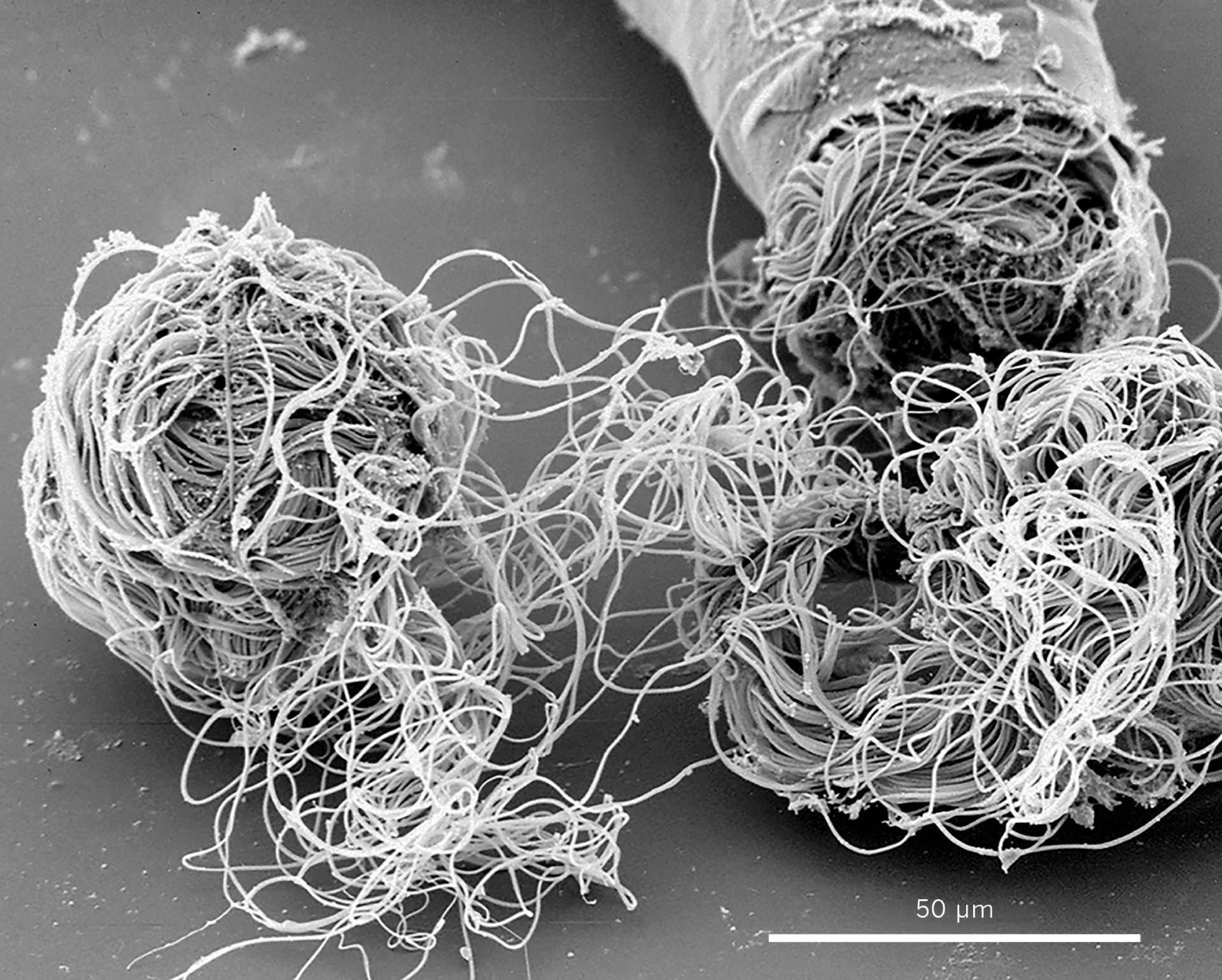 تصویر آزمایشگاهی اسپرم پیچ در پیچ مگس میوه Drosophila bifurca