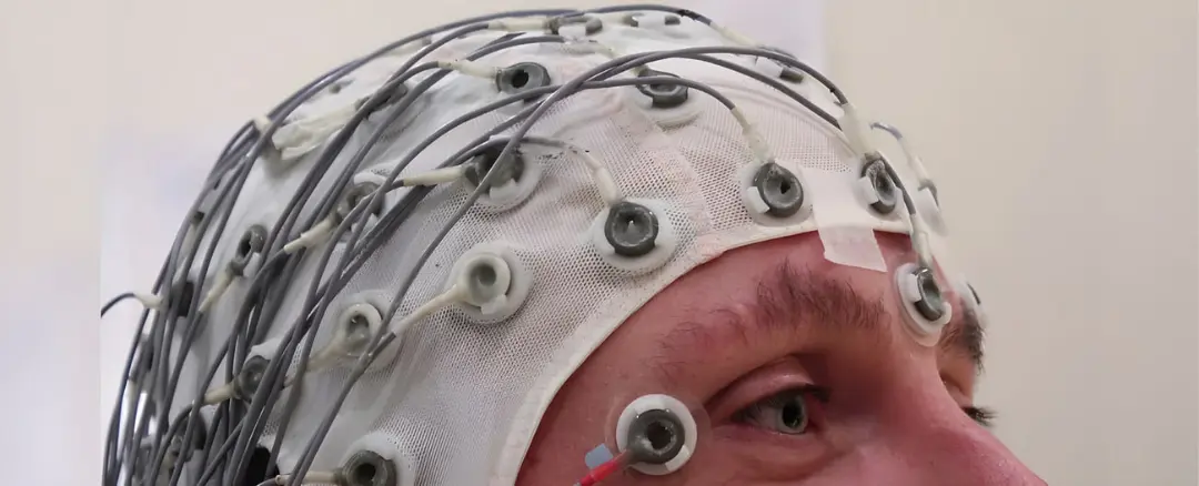 کلاه الکترودهای دستگاه الکتروانسفالوگرافی (EEG) روی سر یک فرد