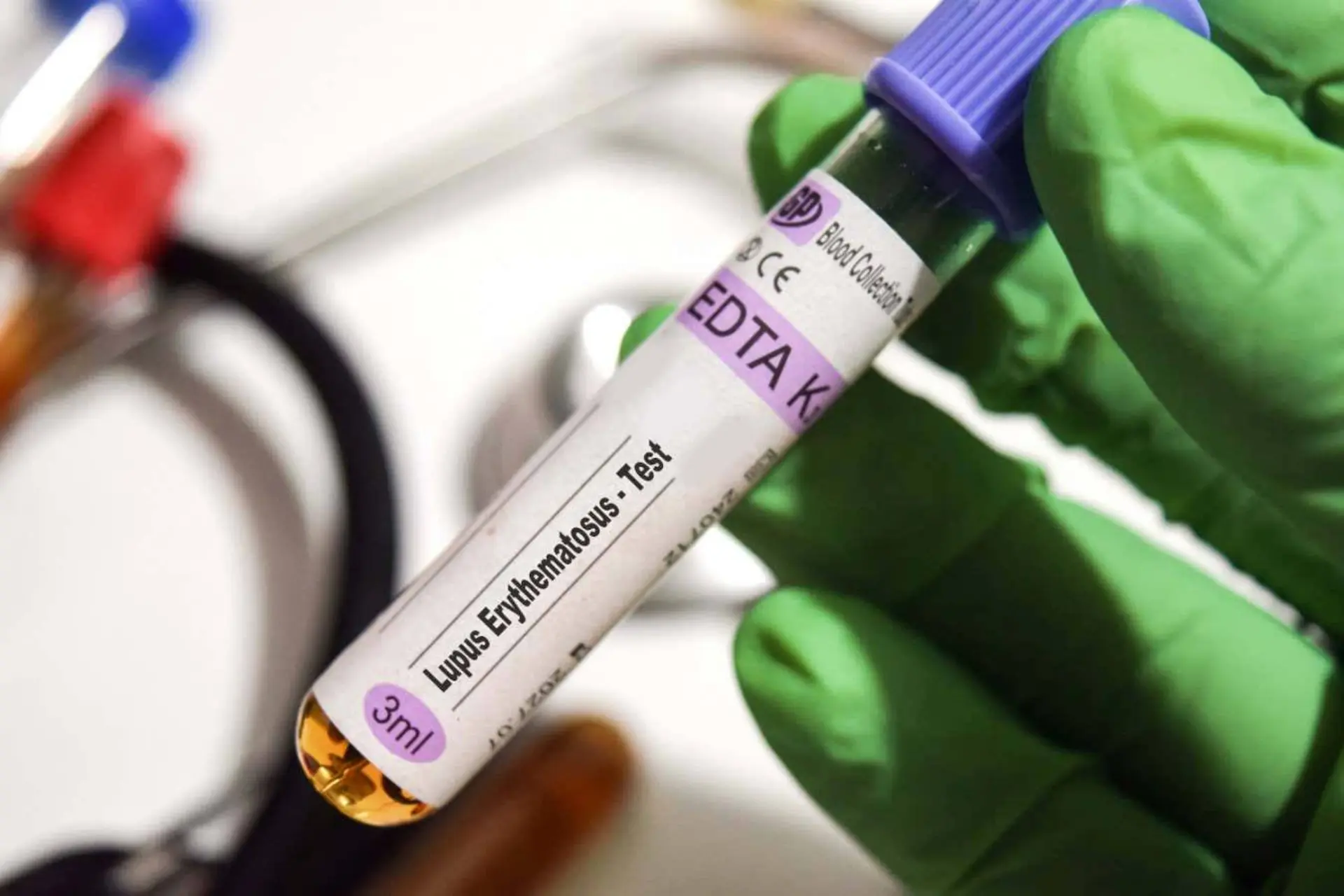 کشف قوی‌ترین شواهد از نقش ویروس اپشتین بار در بروز بیماری لوپوس