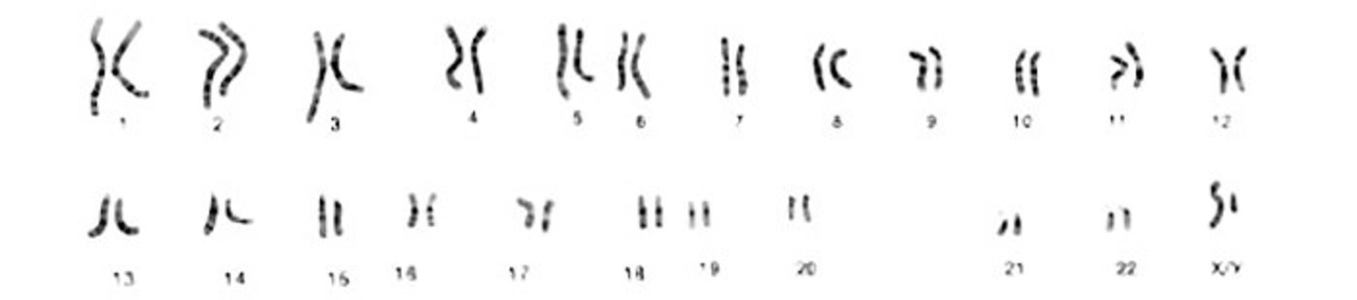 9 dfe03