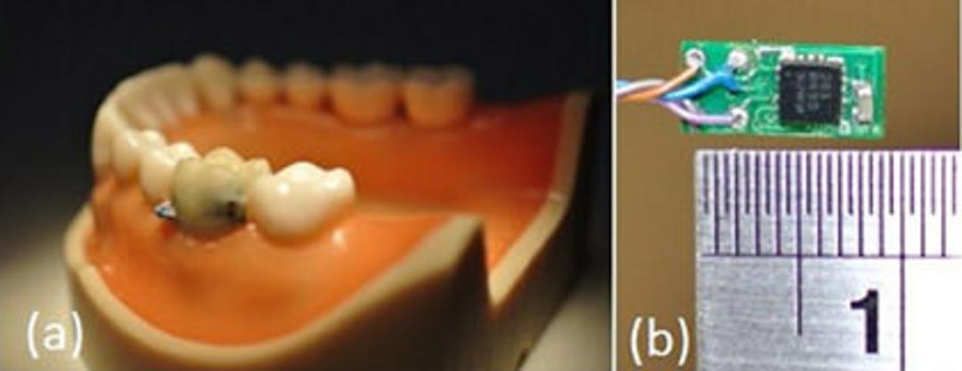 tooth.sensor