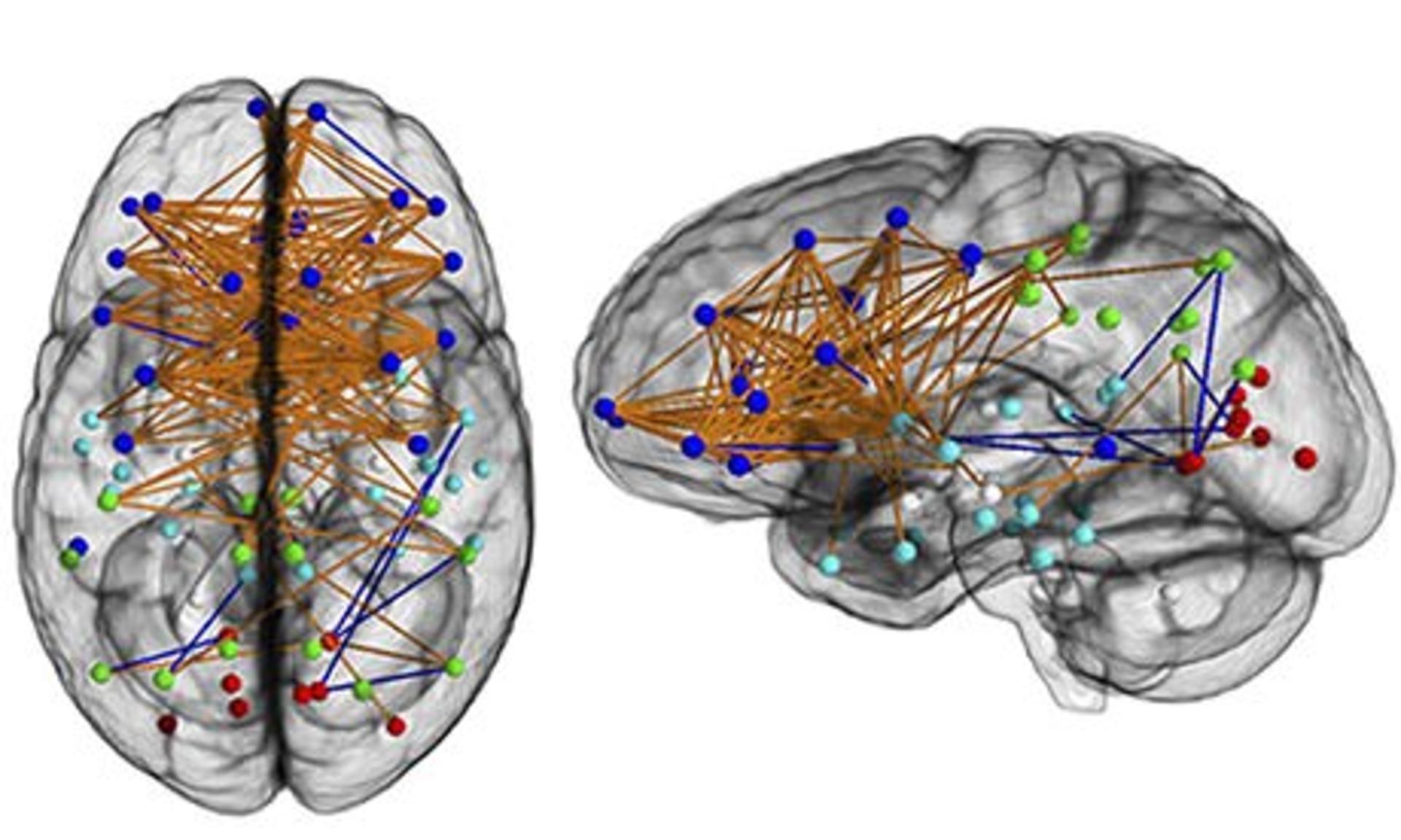 Female-brain-008