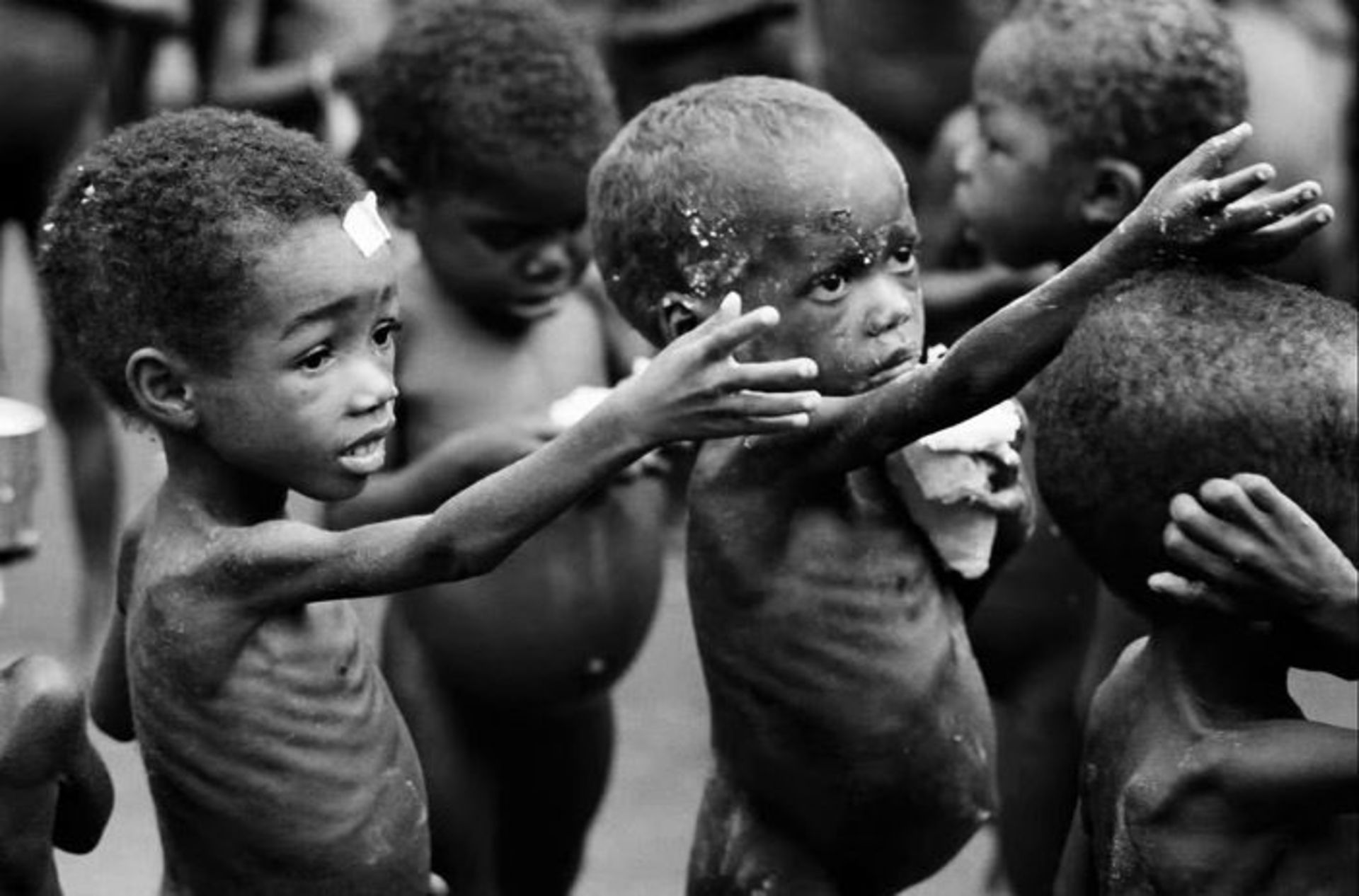 Starving-Child