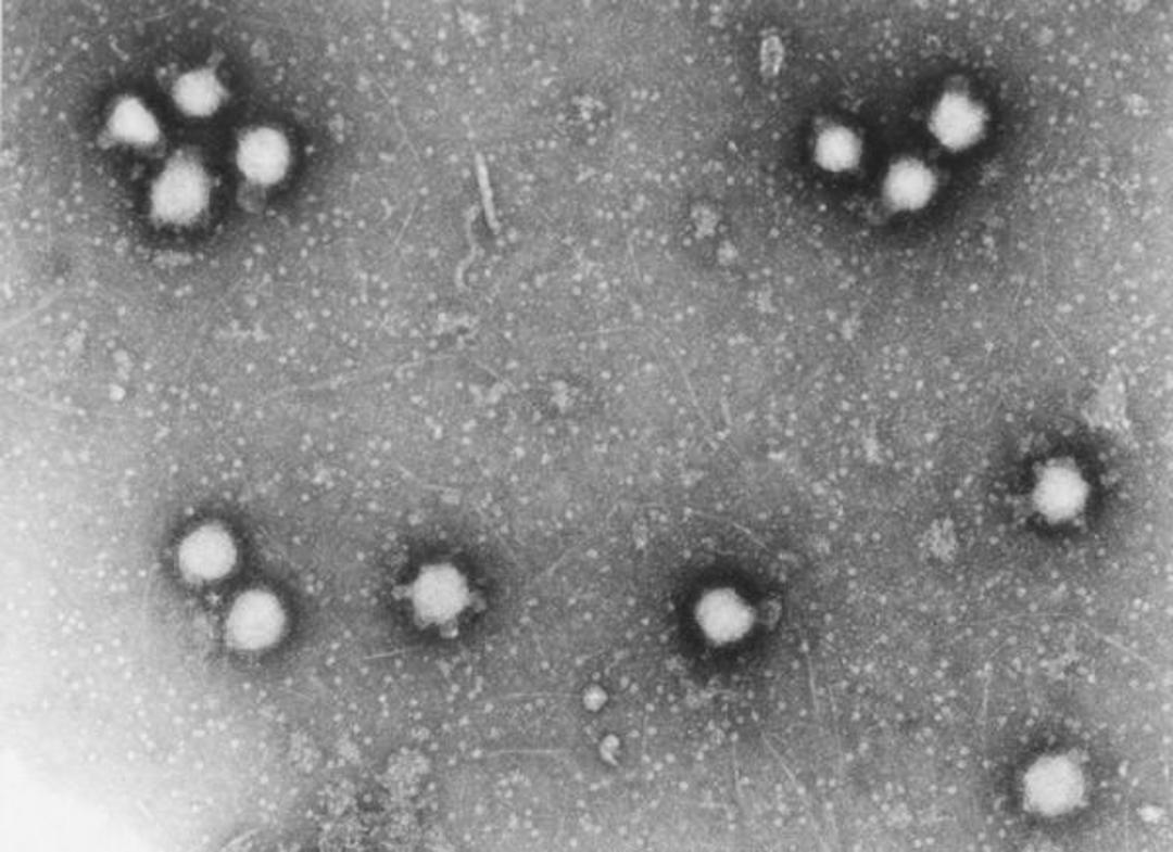 Crimean-Congo-virus