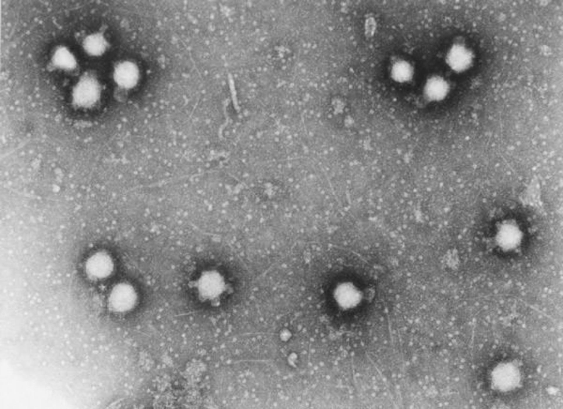 Crimean-Congo-virus