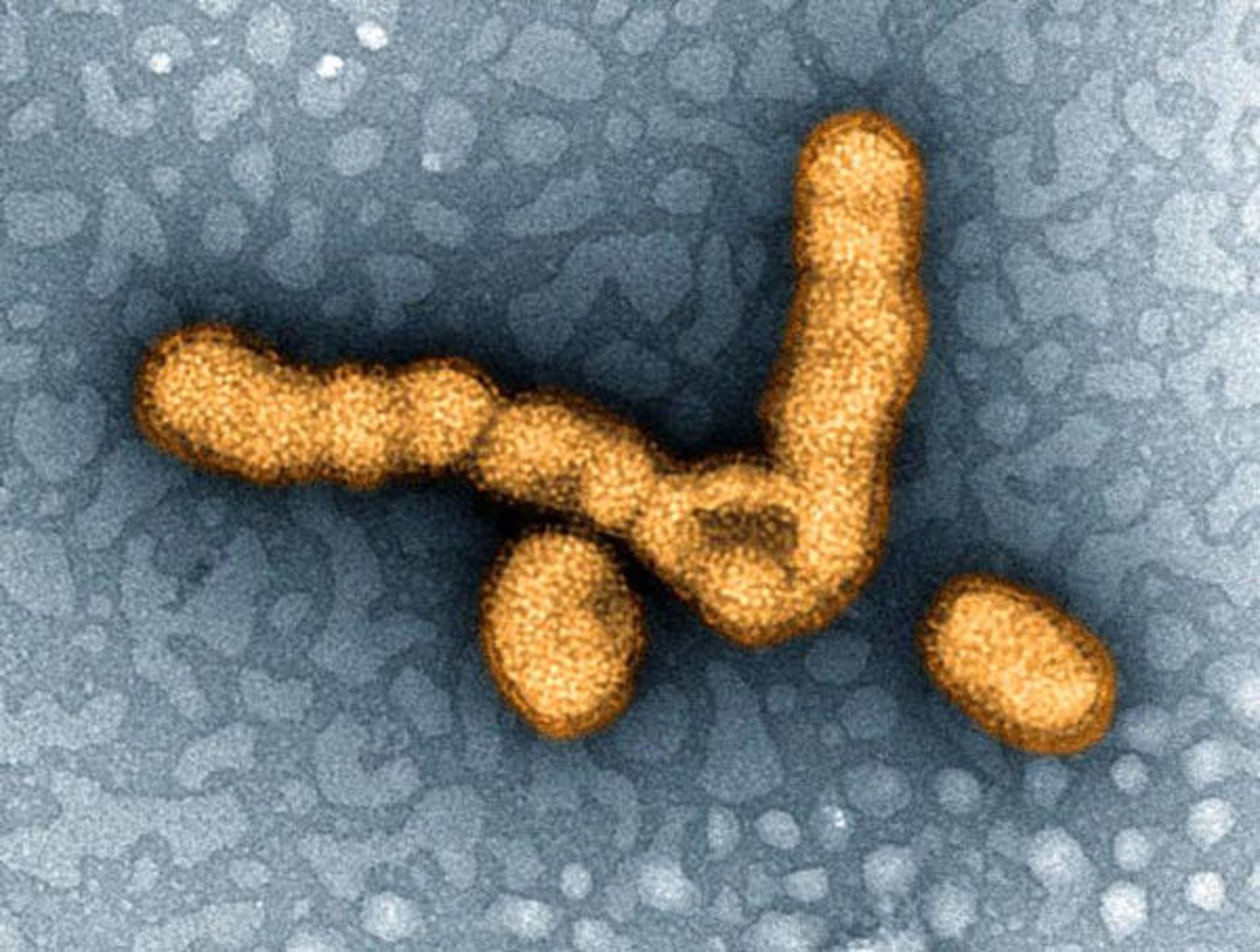 h1n1-virus-141022