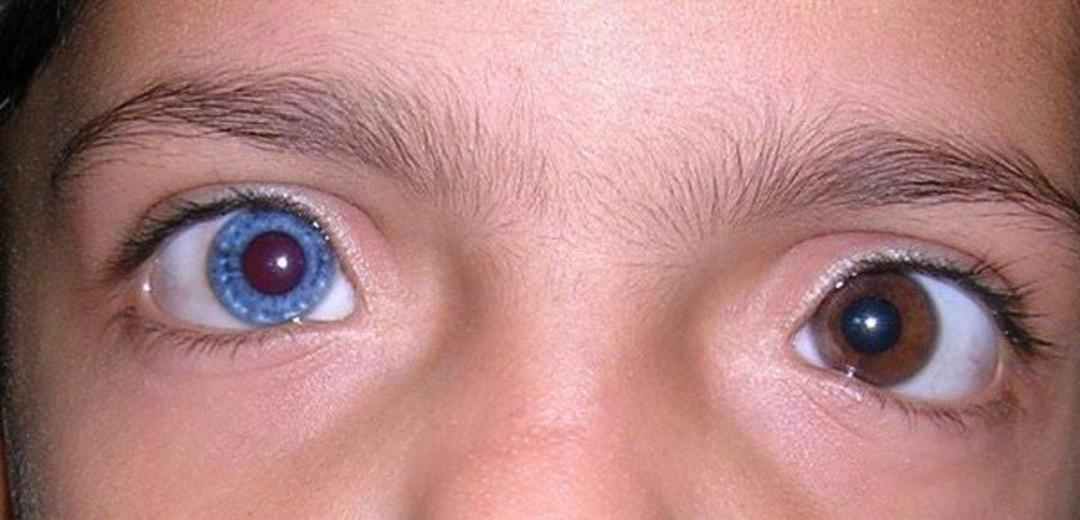 brownvsblue