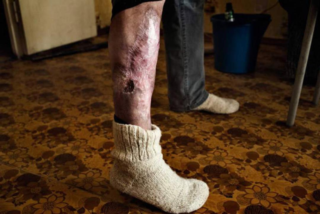 krokodil