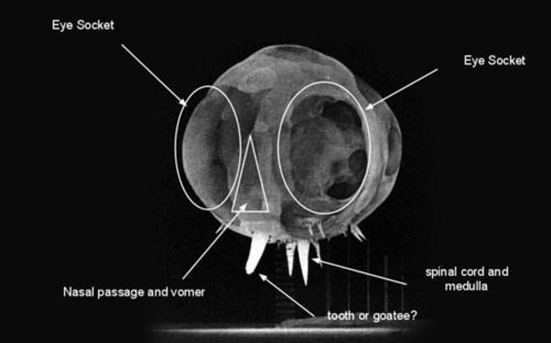 first-milisecond-of-nuclear-bomb-explodation-1
