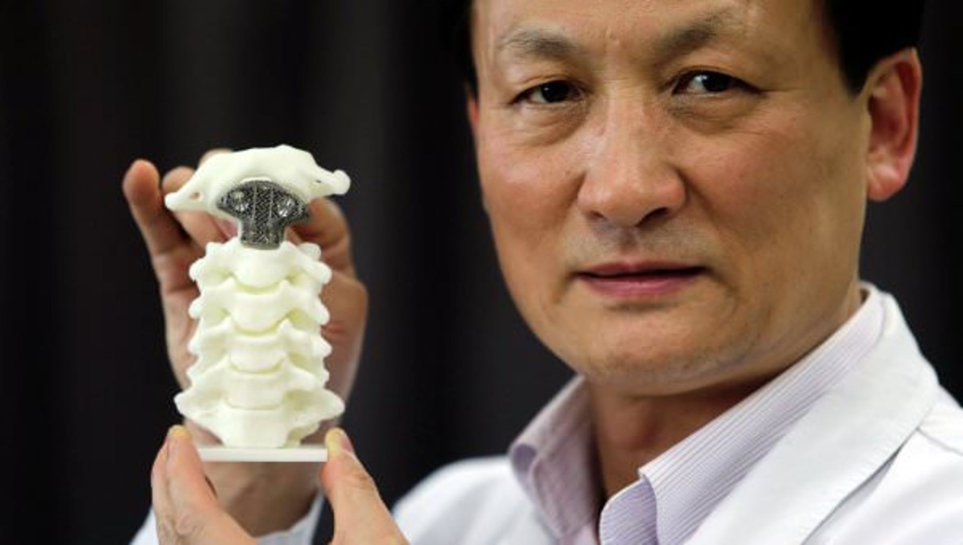 جایگزینی مهره  سرطانی گردن با ایمپلنت تولیدی چاپگر سه بعدی در چین