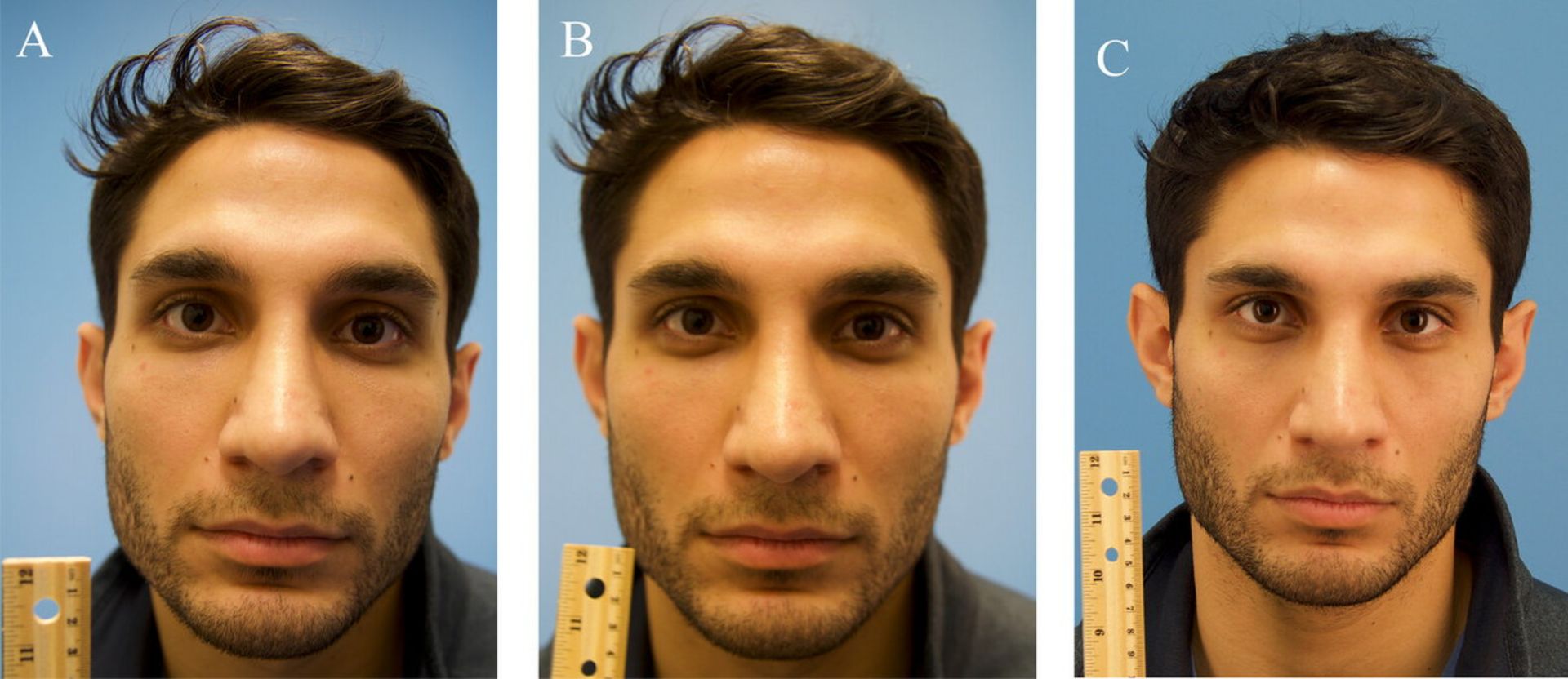 تاثیر اعواج روی عکس صورت