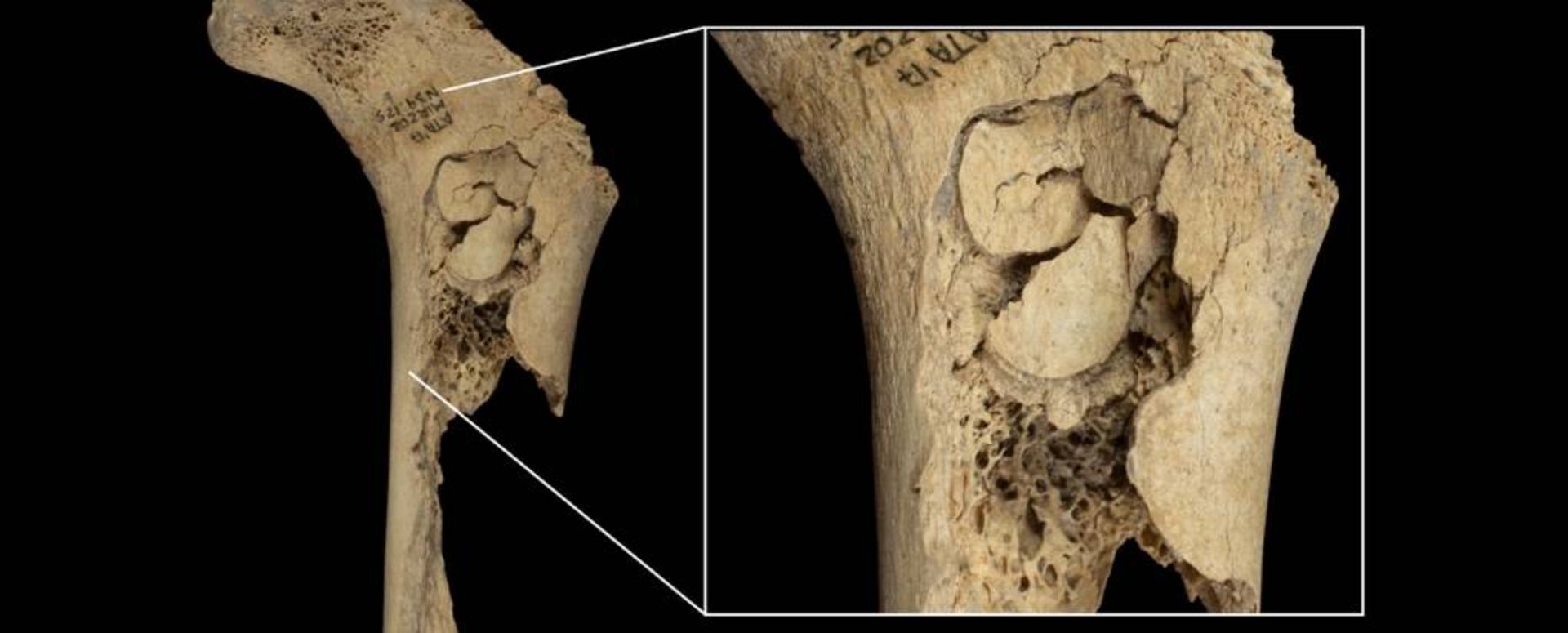 استخوان ران با آثار خارج کردن مغز استخوان