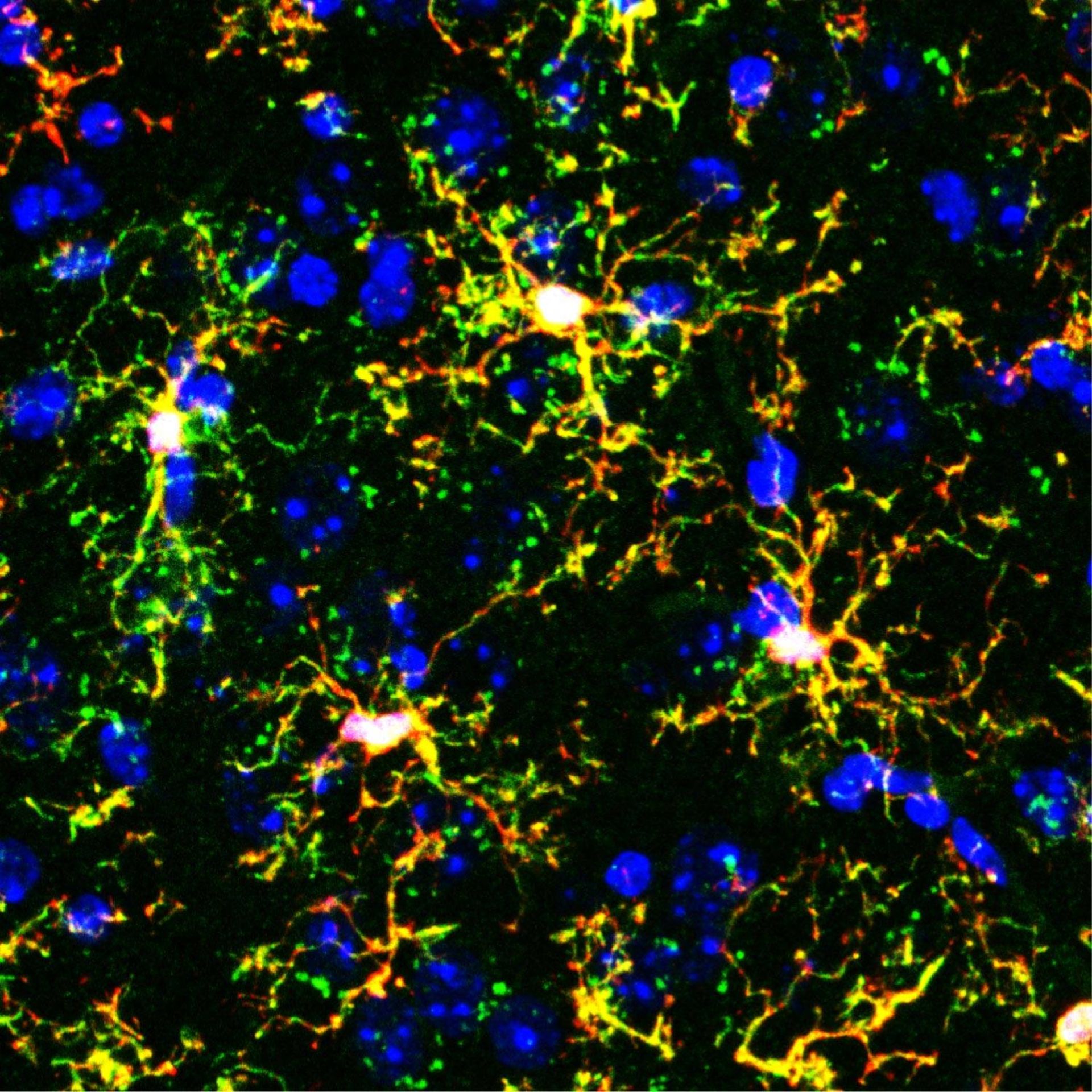 تصویر میکروسکوپی فلورسانس از میکروگلیاهای پیوندی