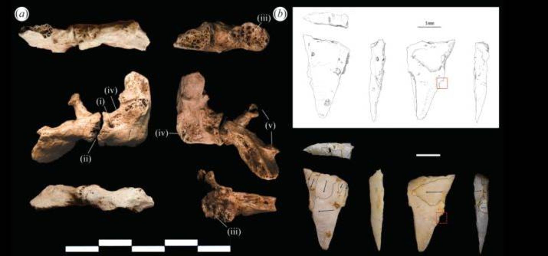 شکستگی‌ٔهای جمجمه باستانی