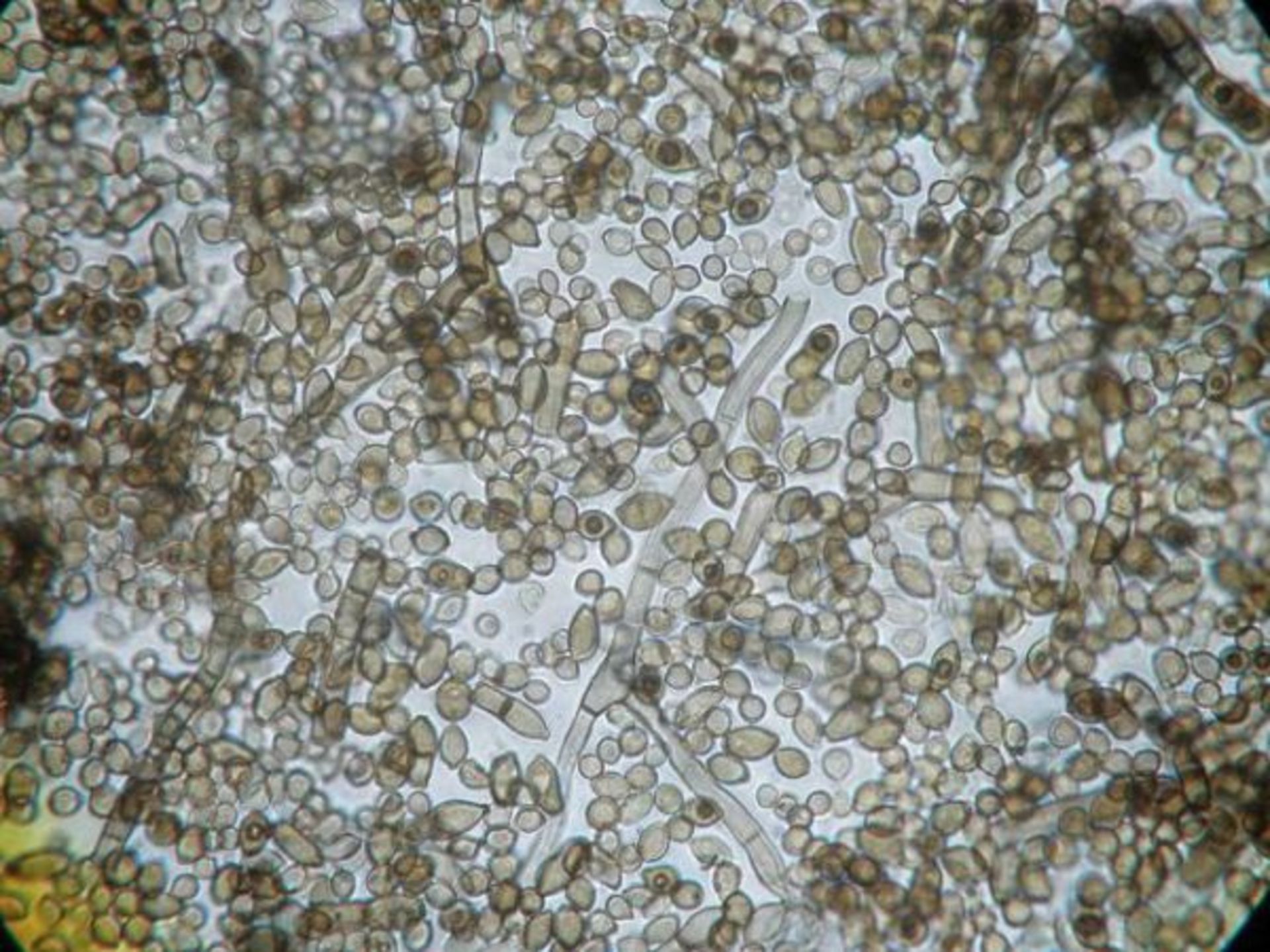 قارچ سیاه کلادوسپوریوم اسفروسپرموم زیر میکروسکوپ