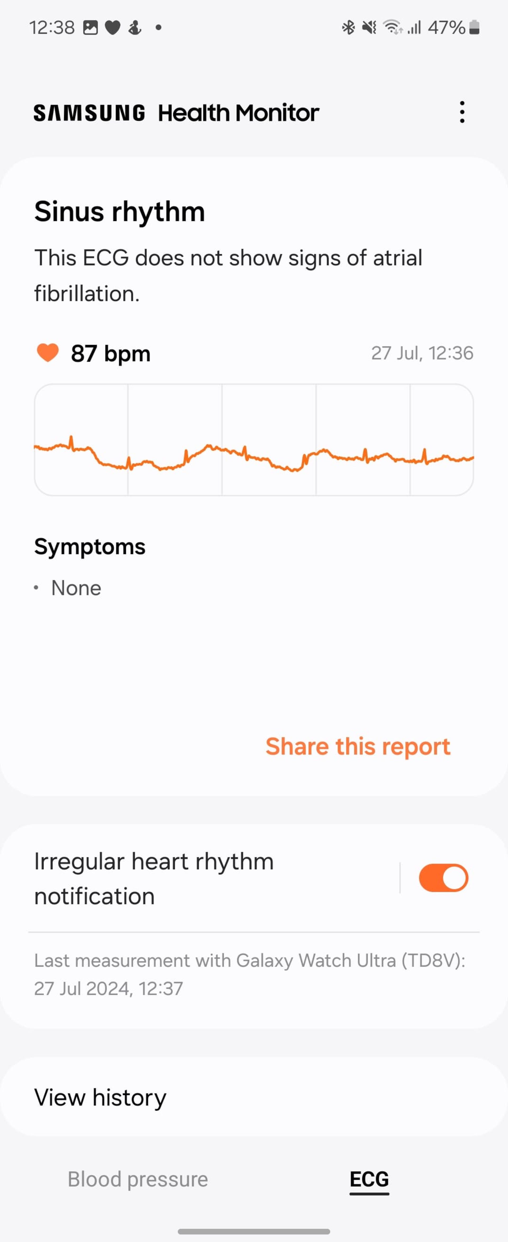 اسکرین شات تست ECG گلکسی واچ اولترا